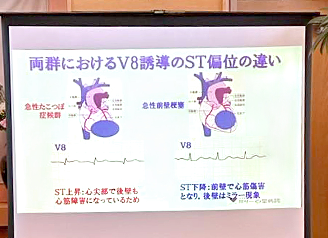 心電図分析