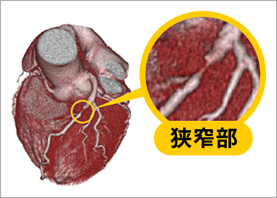 心血管检查