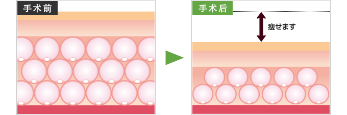 手术前→手术后