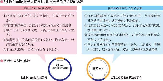 ReLEx smile激光治疗与Lasik准分子治疗近视的比较