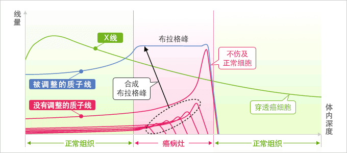 质子线治疗的特征