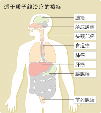 适用质子线治疗的癌症